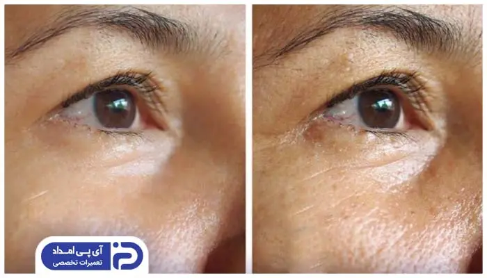 مضرات قهوه برای پوست صورت زنان