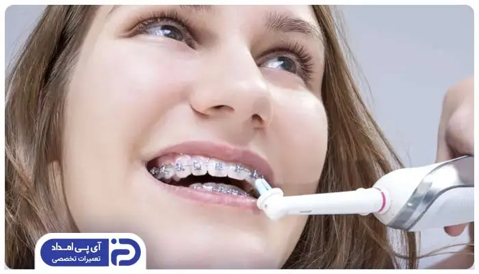 مسواک برقی برای افراد دارای ارتودونسی بسیار کاربردی است